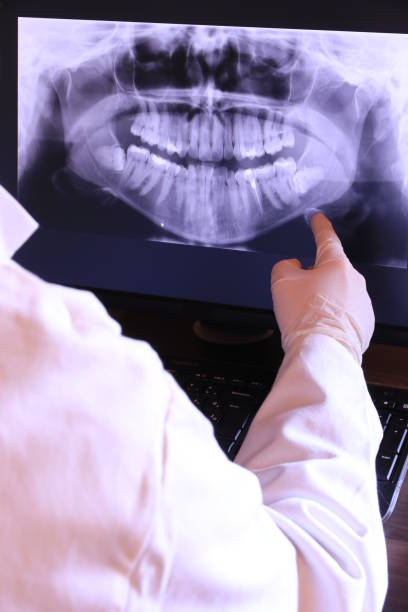 Best Emergency Dental Care for Broken or Chipped Teeth in East Setauket, NY