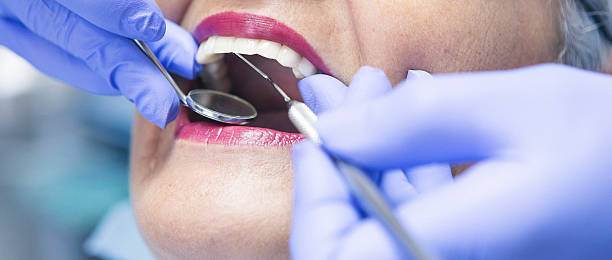 Best Urgent Care for Lost Fillings or Crowns in East Setauket, NY